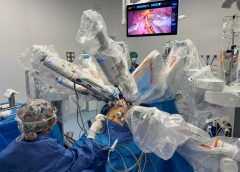 El Hospital Arnau de Vilanova realiza con éxito la primera cirugía bariátrica asistida con el robot HUGO en España