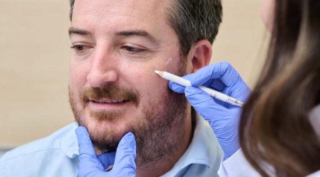 La demanda de bótox en hombres crece impulsada por la naturalidad y la medicina estética personalizada