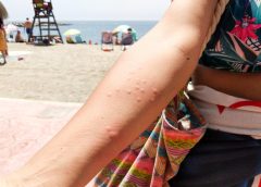 Especialistas de Vithas explican cuándo una picadura de medusa puede convertirse en una urgencia médica